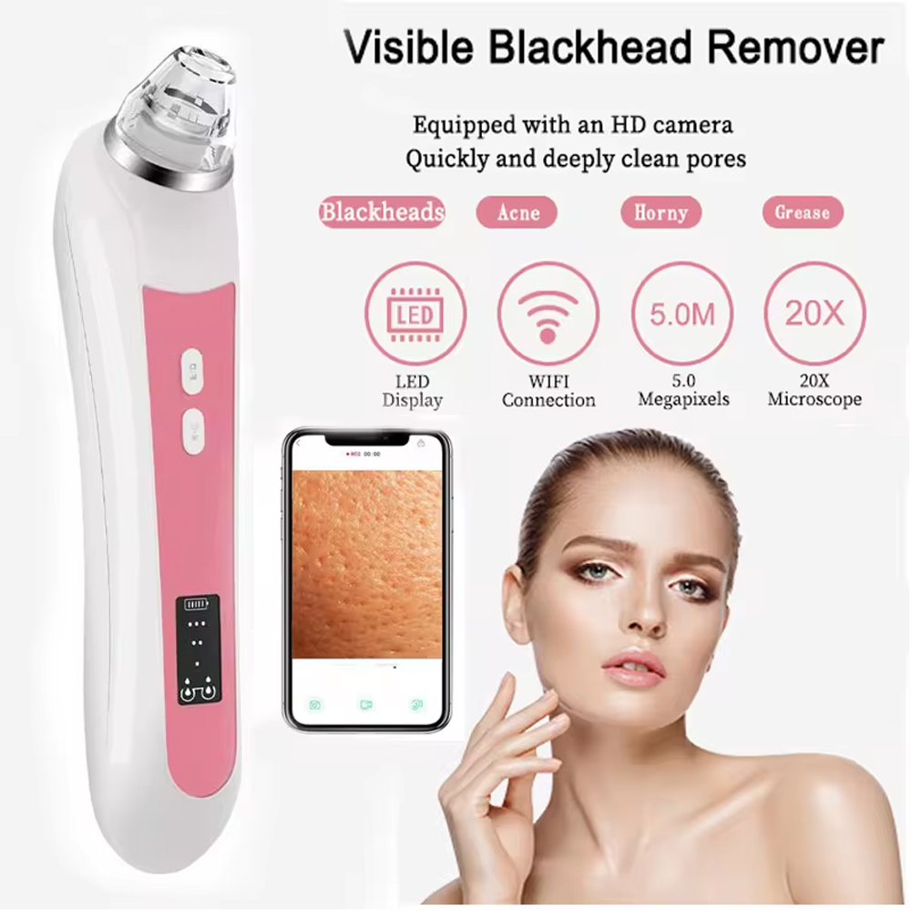 เครื่องดูดกำจัดสิวหัวดำ6เครื่อ - Pore Vacuum บทวิจารณ์และราคา