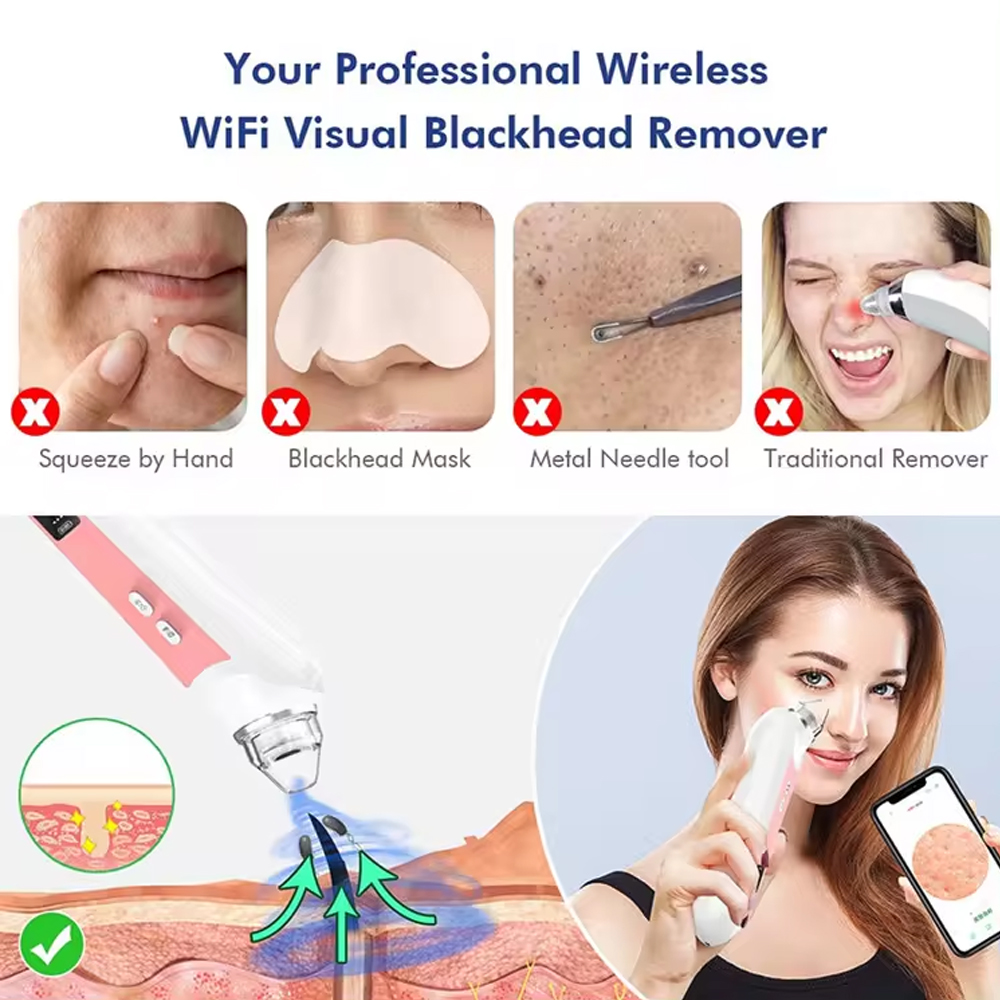 เครื่องดูดกำจัดสิวหัวดำ6เครื่อ - Pore Vacuum บทวิจารณ์และราคา