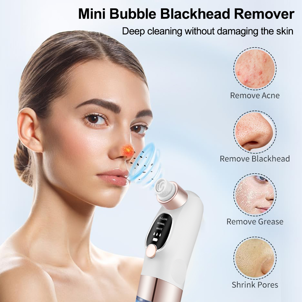 ไฟฟ้า สิวหัวดํา Remover สูญญาก - Pore Vacuum บทวิจารณ์และราคา