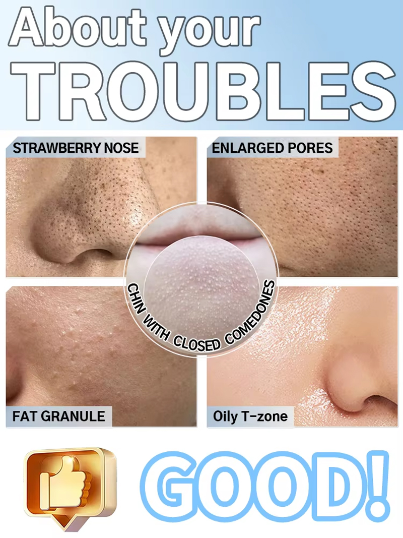 เครื่องดูดสิวเสี้ยนไฟฟ้าสำหรับ - Pore Vacuum บทวิจารณ์และราคา