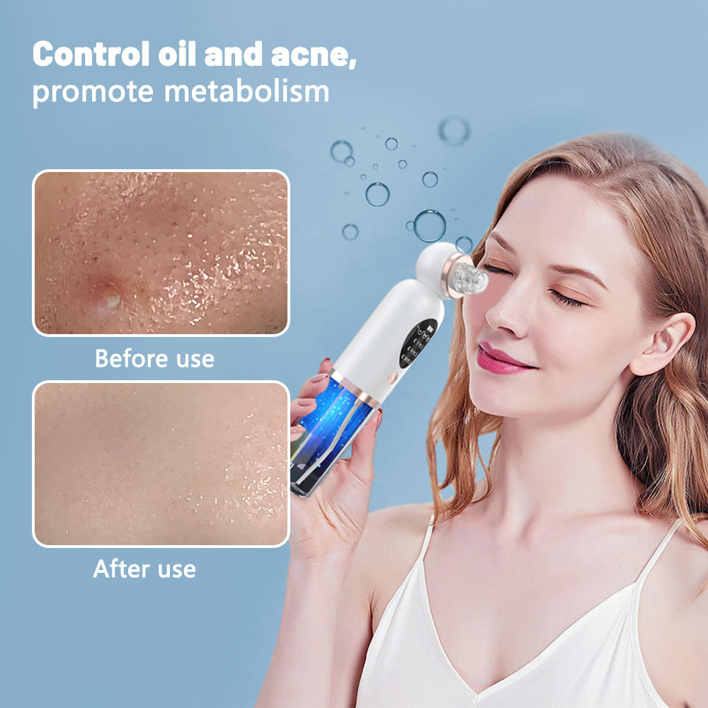 เครื่องดูดสิวเสี้ยน กำจัดสิวอุ - Pore Vacuum บทวิจารณ์และราคา