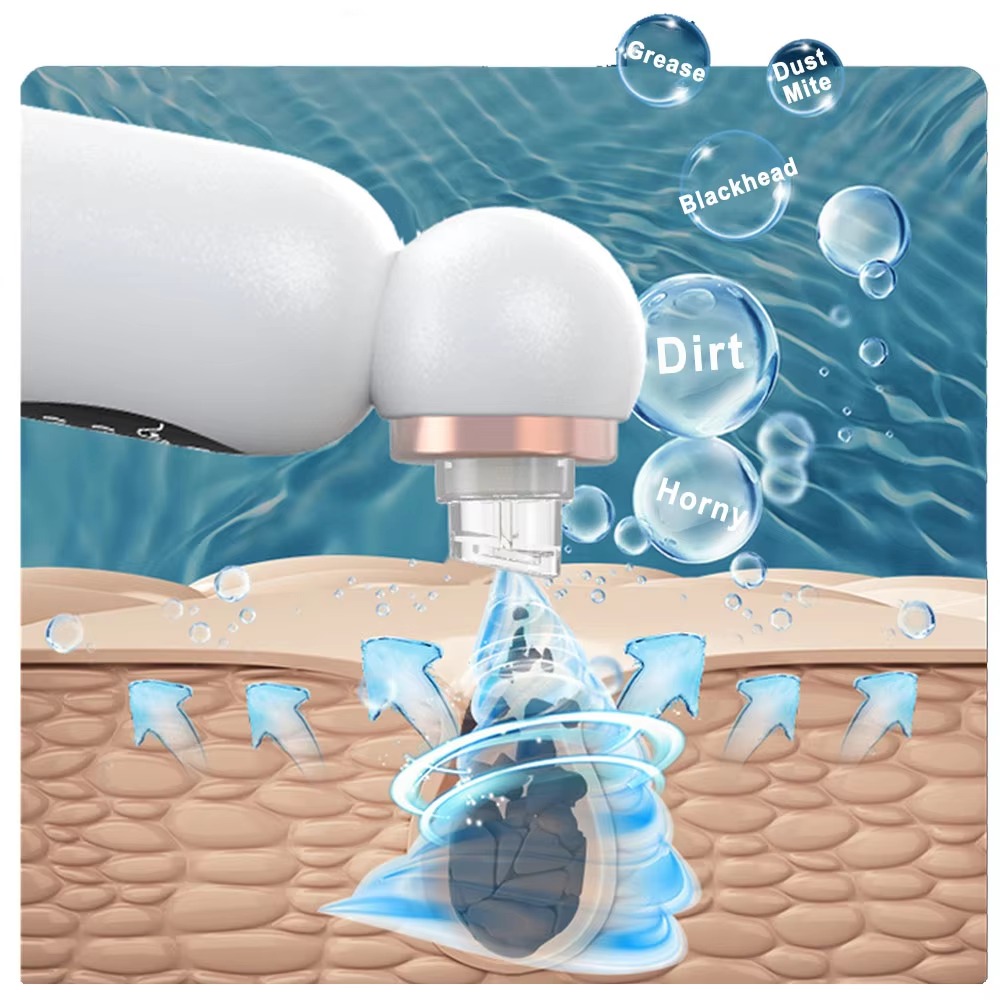 เครื่องดูดสิวเสี้ยน กำจัดสิวอุ - Pore Vacuum บทวิจารณ์และราคา