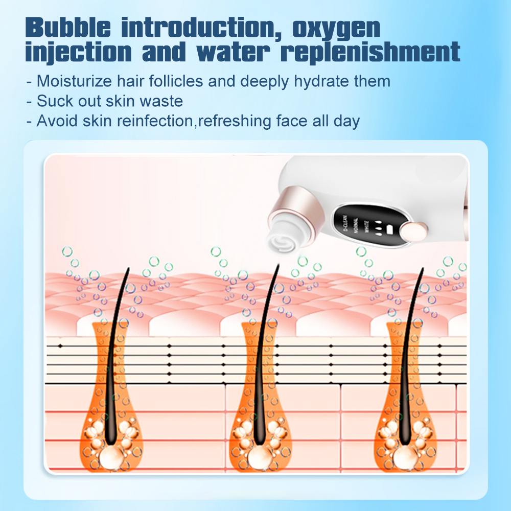 เครื่องดูดสิวเสี้ยนไฟฟ้า เครื่ - Pore Vacuum บทวิจารณ์และราคา