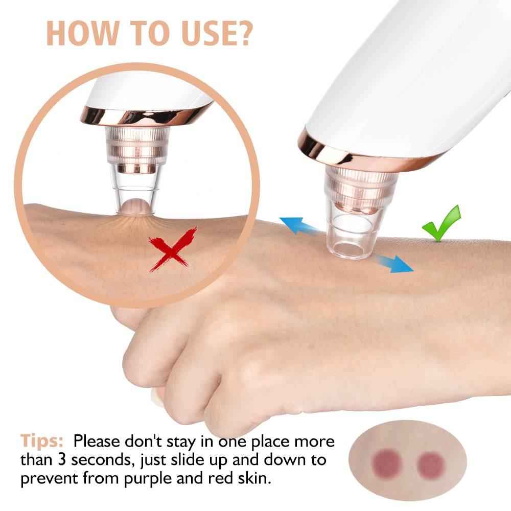 Blackhead Remover สูญญากาศ Por - Pore Vacuum บทวิจารณ์และราคา