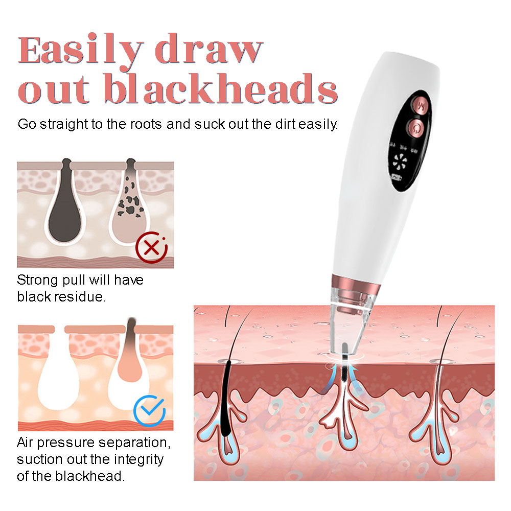 ไฟฟ้า Blackhead Remover เครื่อ - Pore Vacuum บทวิจารณ์และราคา